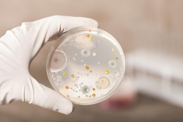 Foto teste de laboratório de microbiologia na mão do cientista no fundo