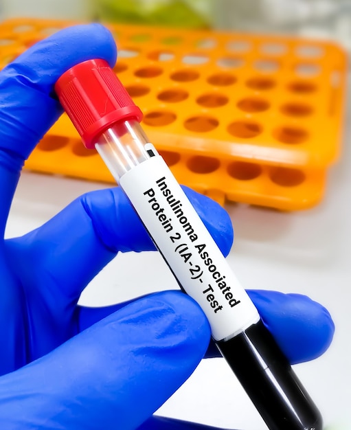 Teste de Proteína Associada a Insulinoma 2. Anticorpo das ilhotas pancreáticas.