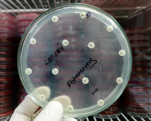 Foto teste de suscetibilidade antimicrobiana em placa de petri