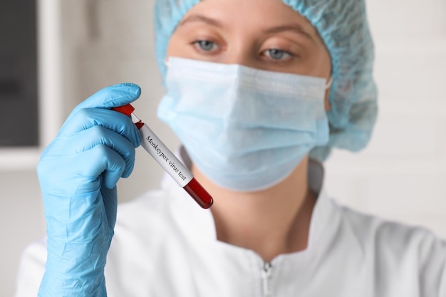 Teste de vírus Monkeypox Trabalhador de laboratório segurando tubo de amostra com sangue dentro de casa foco na mão