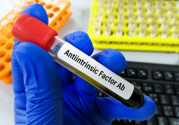Teste do fator intrínseco Ab, para confirmar o diagnóstico de anemia perniciosa. Anticorpo anticélula parietal.