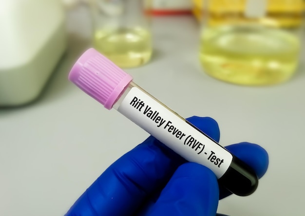 Teste do vírus da febre do vale do Rift, um vírus RNA da família Bunyaviridae, transmitido de animais infectados