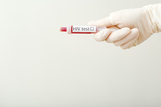 Teste médico de hiv aids. teste de hiv em médicos mão na luva em um fundo branco com espaço para texto