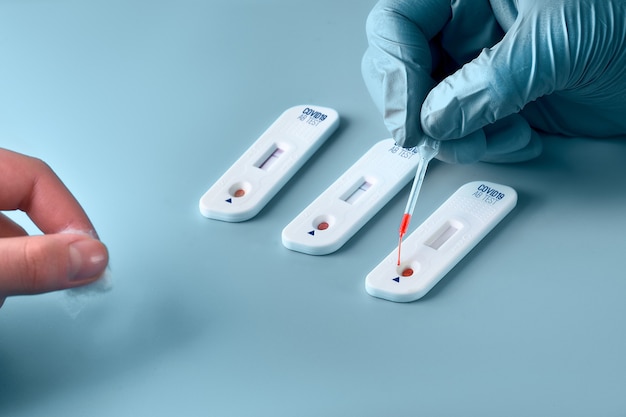 Teste rápido COVID-19 para detectar anticorpos para o novo coronavírus SARS-CoV-2, causando Covid-19.