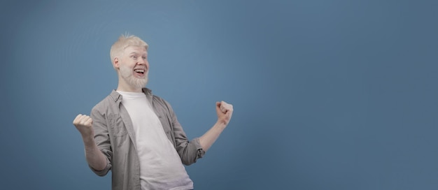 Ótimas notícias, cara albino, gritando e sacudindo os punhos cerrados, posando sobre fundo azul