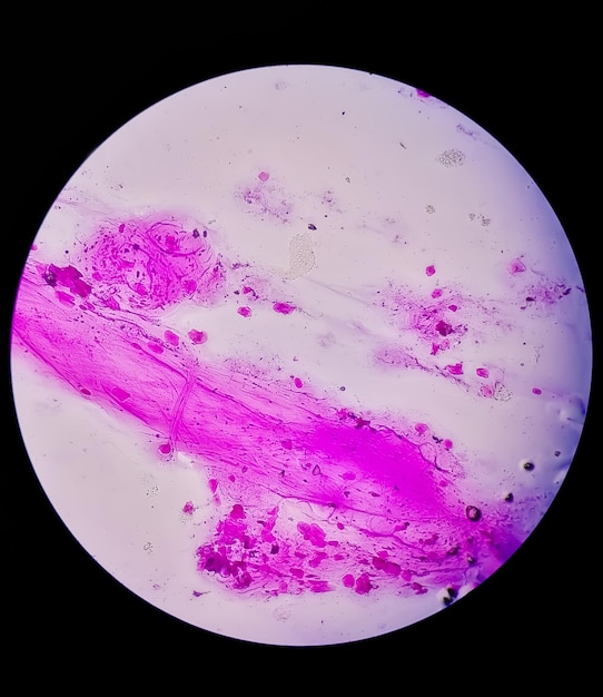 La tinción de Gram, también llamada método de Gram, es un método para diferenciar especies bacterianas.