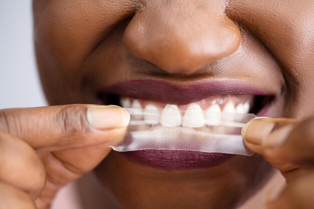 Tirita para blanquear los dientes