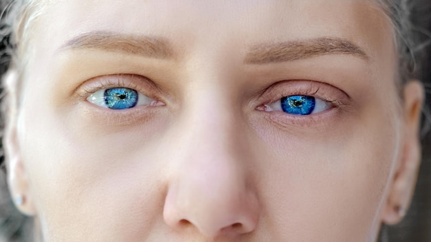 Foto tiro macro de tristes ojos azules y párpados hinchados joven hermosa rubia mira a los ojos de la cámara de gir