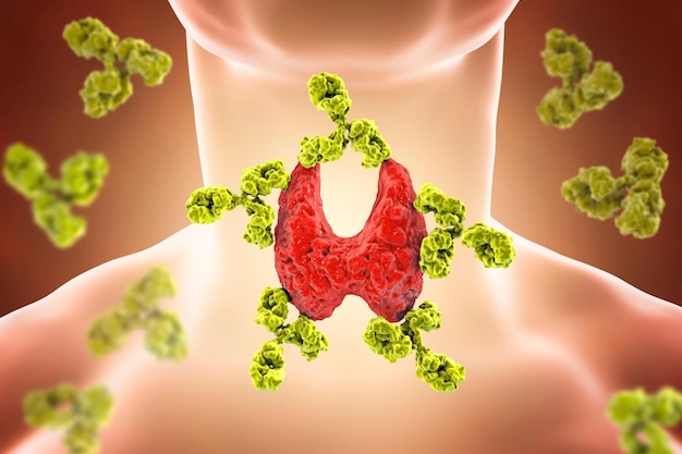 Foto la tiroiditis autoinmune la enfermedad de hashimoto ilustración en 3d que muestra anticuerpos que atacan la glándula tiroidea