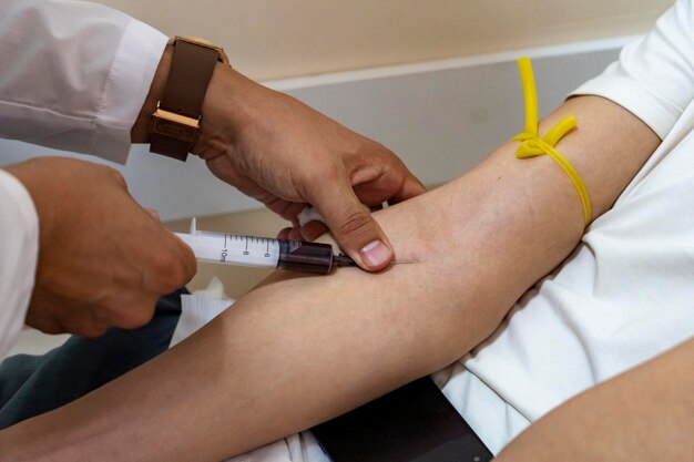 Foto toma de muestras de sangre de un paciente masculino, médico masculino, jeringa de 10 ml, inyección iv con sangre en el foso cubital cercano.