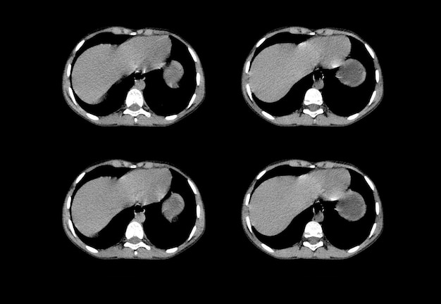 Tomografia computadorizada de tórax e imagens criativas de ressonância magnética