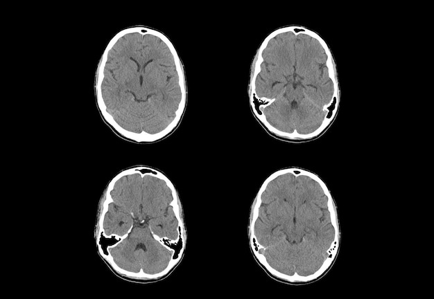 Tomografía computarizada y resonancia magnética del cerebro imágenes únicas y profesionales