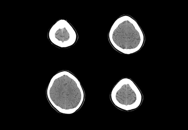 Tomografía computarizada y resonancia magnética del cerebro imágenes únicas y profesionales