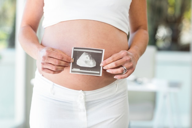 Torso de mujer sosteniendo ecografía