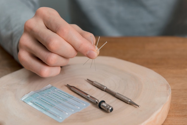 Tratamento de acupuntura nas mãos do homem, agulhas.