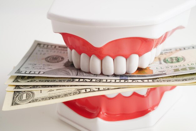 Tratamento de cuidados dentários custo de despesas dentárias ou taxa de dólar americano moeda de banco com modelo de dentes