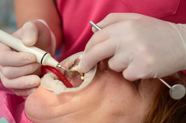 Tratamento odontológico no dentista o médico trata os dentes superiores do paciente