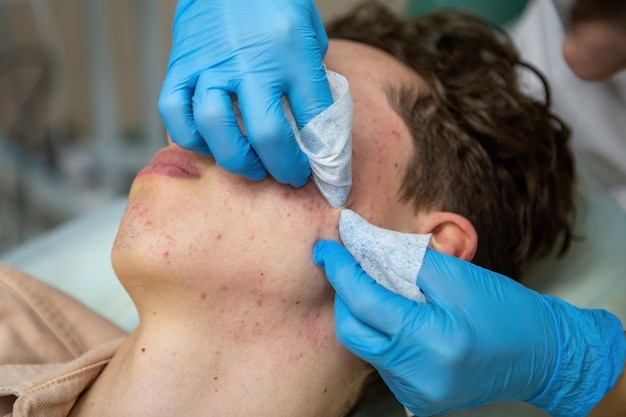 Tratamiento del acné en adolescentes por un dermatólogo