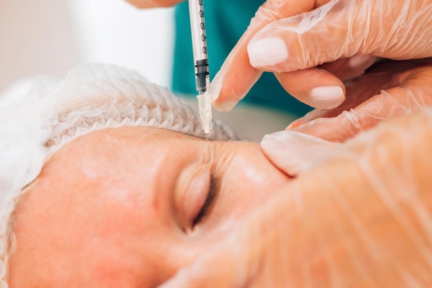 Treinamento do médico mestre cosmetologista prática de marcação a lápis de injeção de Botox