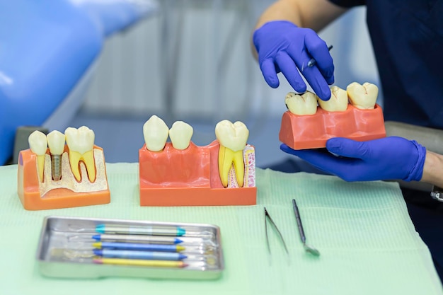 Foto treinamento, educação, prática de trabalho dentário. modelo de demonstração de dente, implante e coroa na mandíbula para o paciente. dentes fictícios na clínica dentária.