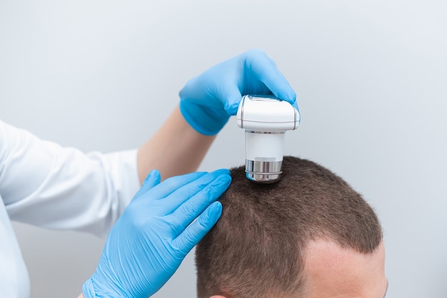 Foto tricoscopia de cabello y cuero cabelludo