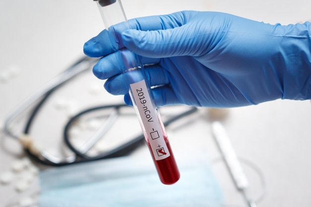 Tubo de análisis de sangre en la mano del médico, prueba de coronavirus Mers-CoV Etiqueta positiva en el tubo de análisis de sangre del hospital para análisis. Infección por el virus 2019-nCoV originada en Wuhan, China