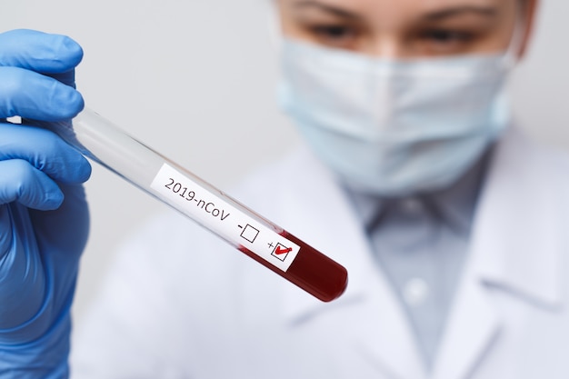 Tubo de análisis de sangre en la mano del médico, prueba de coronavirus Mers-CoV Etiqueta positiva en el tubo de análisis de sangre del hospital para su análisis. Infección por el virus 2019-nCoV