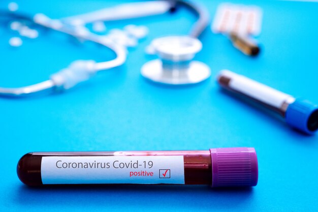 Foto tubo com resultado positivo no exame de sangue de coronavírus (covid-19)