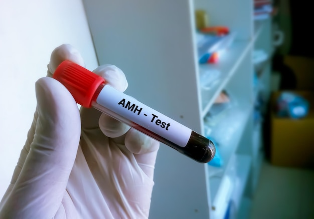 Tubo de amostra de sangue para amh ou teste de hormônio anti-mulleriano