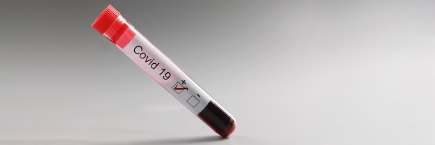 Tubo de ensaio com resultado de sangue positivo para coronavírus em fundo cinza