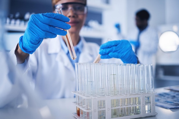 Tubo de ensaio de ciência nas mãos e mulher negra em laboratório para pesquisa, estudo médico e experimento Farmacêutico de saúde e cientista feminina com remédio para frasco líquido e vacina na clínica