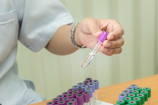 Tubo de sangue com solução preparar para manter o sangue