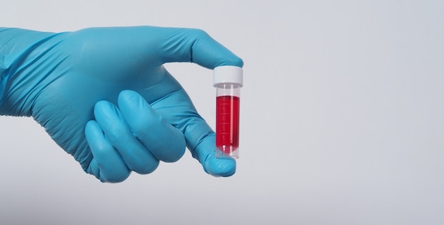 Tubo de sangue. mão do médico segurando um tubo de amostra de sangue para análise