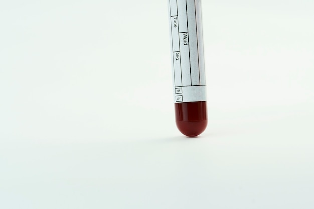 Foto tubo de vácuo para coleta e amostras de sangue em fundo branco. rótulo para identificar os dados. foco seletivo.