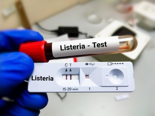 Tubo de ensayo y casete de prueba rápida para el diagnóstico de prueba de bacterias Listeria para Listeriosis