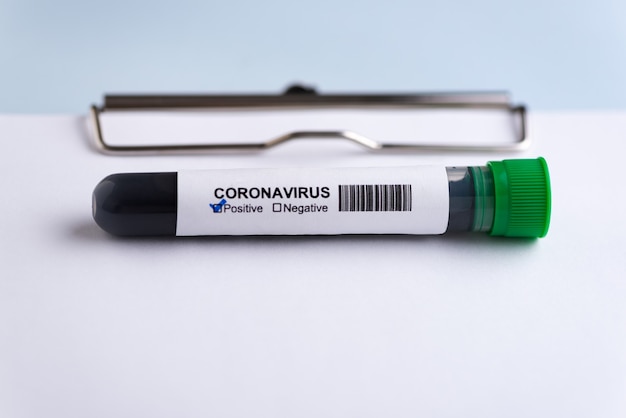 Tubo de ensayo de coronavirus positivo en el portapapeles. Concepto de protección contra coronavirus (COVID19).