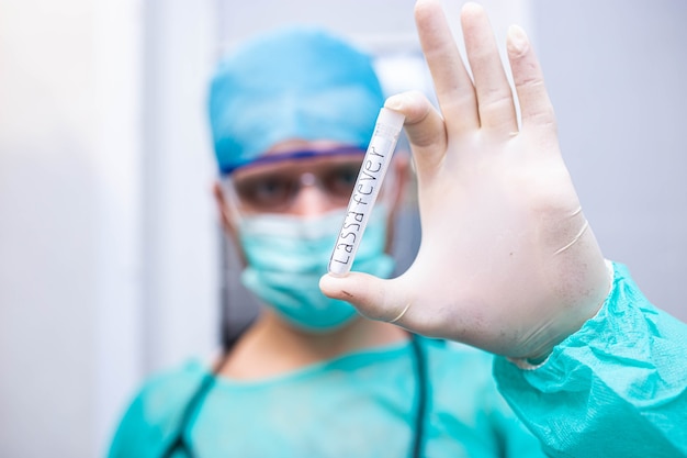 Tubo de ensayo en el laboratorio con fiebre de Lassa.