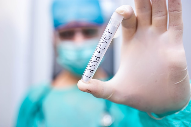 Tubo de ensayo en el laboratorio con fiebre de Lassa.