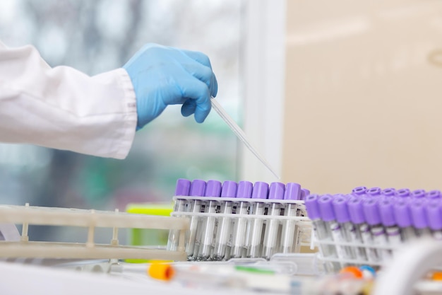 Tubo de ensayo en mano científico en laboratorio. Doctor en uniforme trabajando con tubo de ensayo para análisis en el laboratorio.