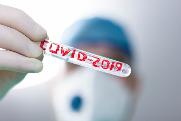 Foto tubo de ensayo médico con coronavirus covid 2019 en manos de un investigador de un médico científico