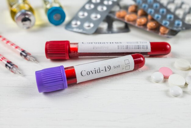 Tubo de ensayo con sangre para análisis de 2019nCoV diferentes pastillas Nuevo concepto de análisis de sangre para coronavirus chino