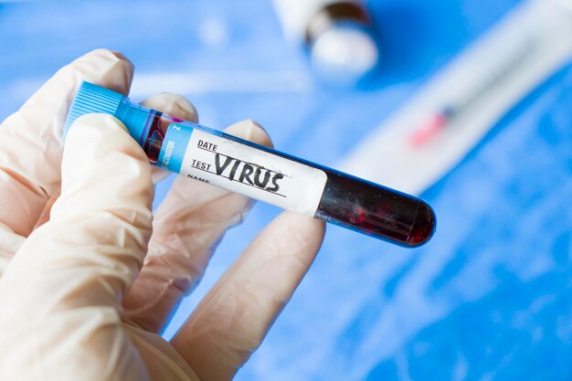 Foto tubo de ensayo de sangre de virus en vasos de laboratorio y reactivos en laboratorio