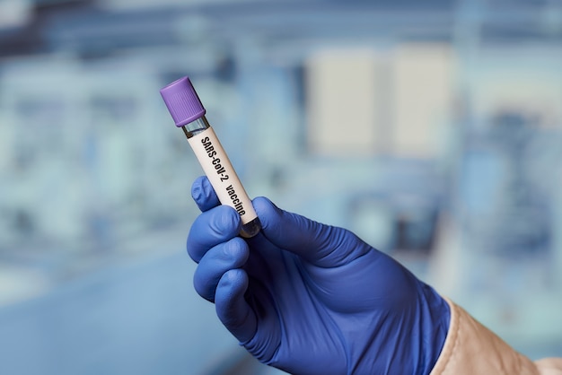 Un tubo de ensayo con una vacuna contra el coronavirus (COVID-19) en el laboratorio.