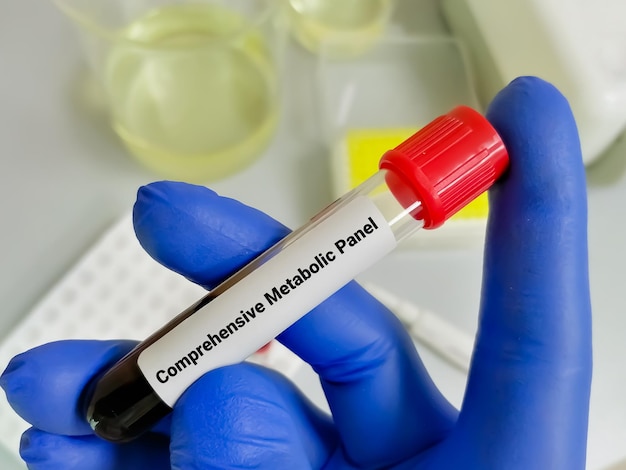 Tubo de muestra de sangre para análisis de CMP o Panel Metabólico Integral en laboratorio