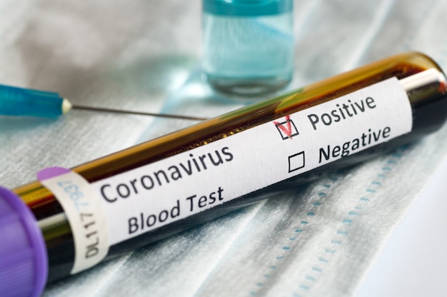Foto tubo de muestra de sangre positivo con covid o nuevo coronavirus sarscov