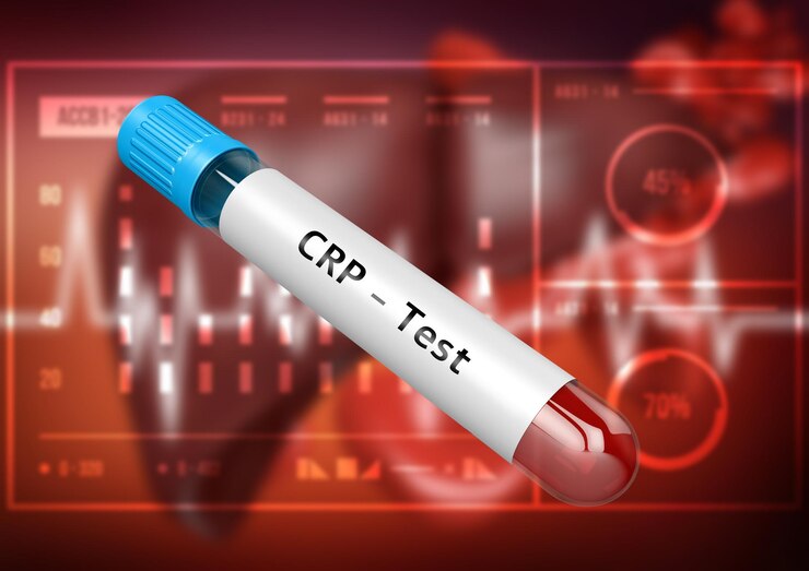 Foto tubo de muestra de sangre para la prueba de pcr con proteína creactive