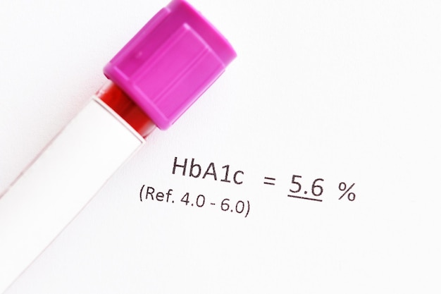 Foto tubo de muestra de sangre con resultado normal de la prueba de hba1c