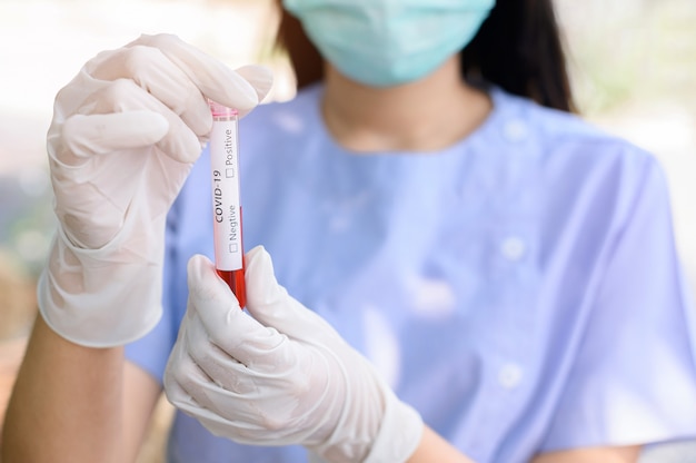 Tubo de sangre de retención de enfermería COVID-19. Desenfoque Enfermeras con máscaras y guantes Para prevenir enfermedades transmisibles. Examen de sangre de coronavirus.