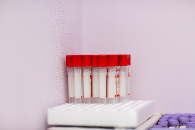 Tubos de análisis de sangre en laboratorio médico