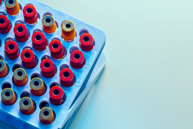 Tubos com amostras de sangue na mesa do laboratório